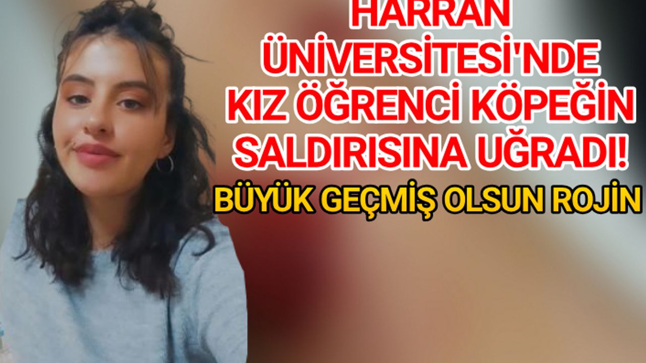 Bir köpek saldırısı da Urfa'da yaşandı..