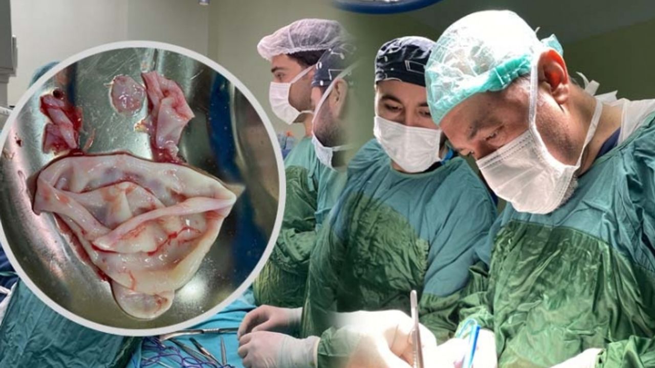 Karın ağrısıyla gittiği hastanede ameliyat oldu