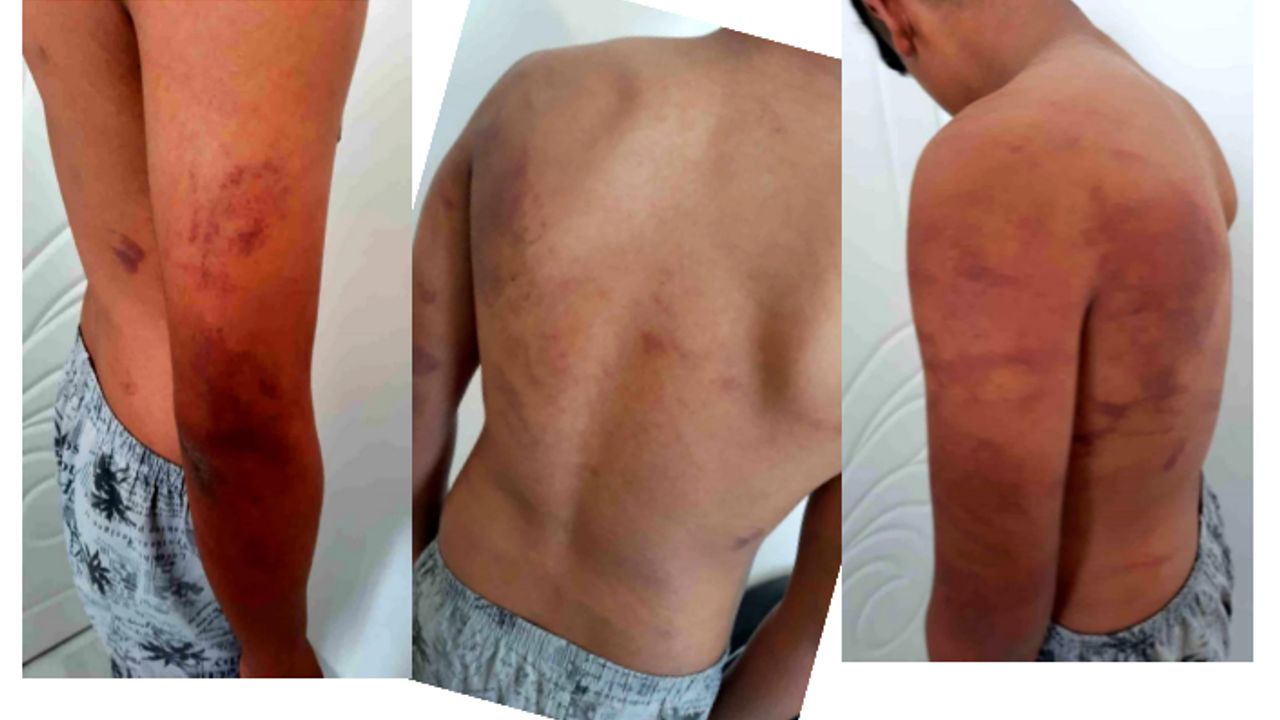 Ahırda işkence gören gencin ifadesi kan dondurdu