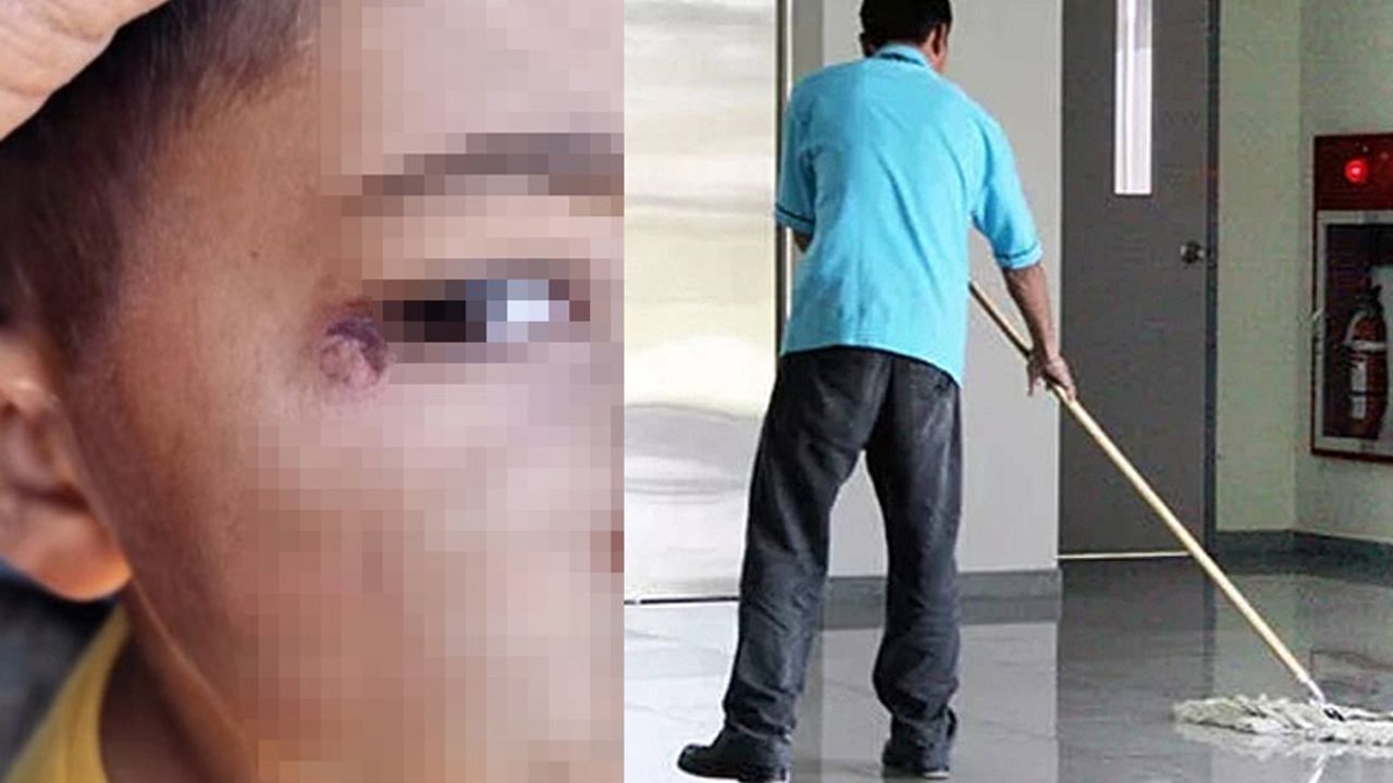 Urfa'da öğrencinin yüzünde sigara söndürüldü!