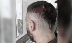 Urfa'da öğretmene çirkin saldırı!