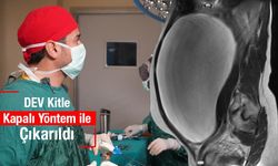 Urfa'da bir kadının karnından dev kitle çıkarıldı