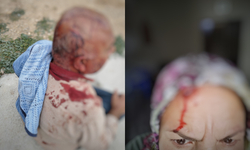 Urfa'da hazine arazisi gerilimi! İki kişi darp edildi