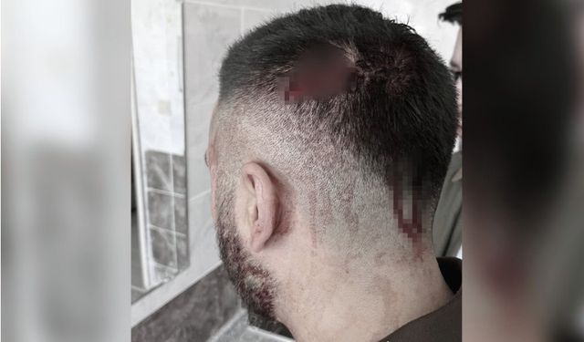 Urfa'da öğretmene çirkin saldırı!