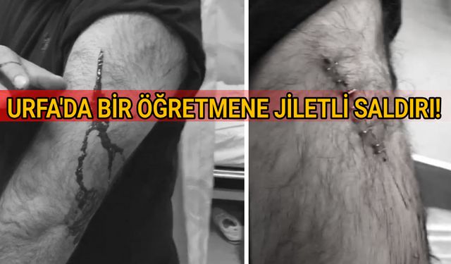 Şanlıurfa’da Öğretmene Jiletli Saldırı: Para İstemini Reddetti, Kolundan Yaralandı