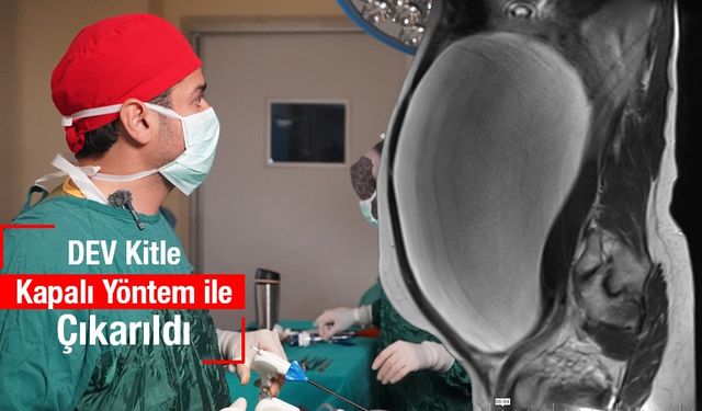 Urfa'da bir kadının karnından dev kitle çıkarıldı