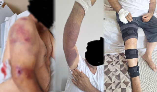 Bozova’da tarlada dehşet! Çiftçiye sopalı ve silahlı saldırı