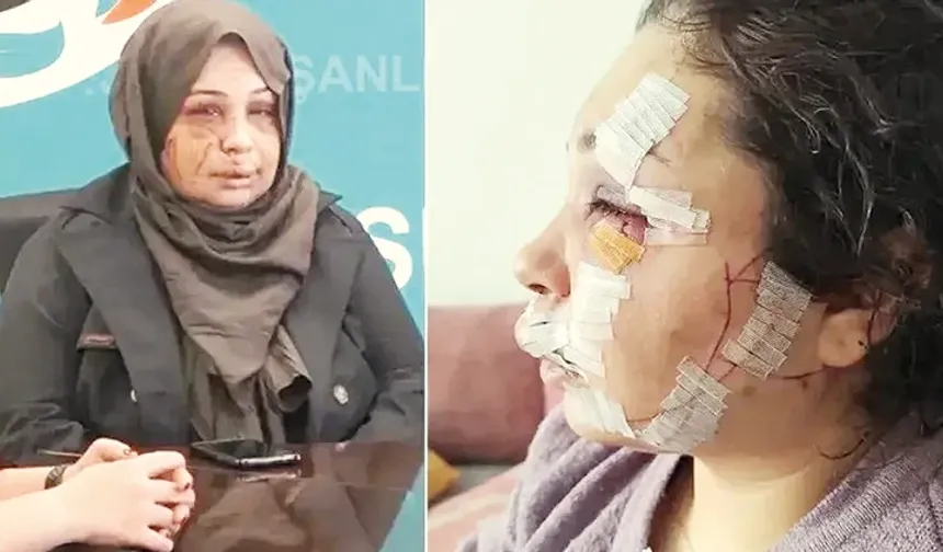 Boşanmak isteyen eşine dehşeti yaşatmıştı! Ödül gibi ceza aldı