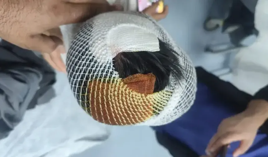 Urfa’da başıboş köpek dehşeti!