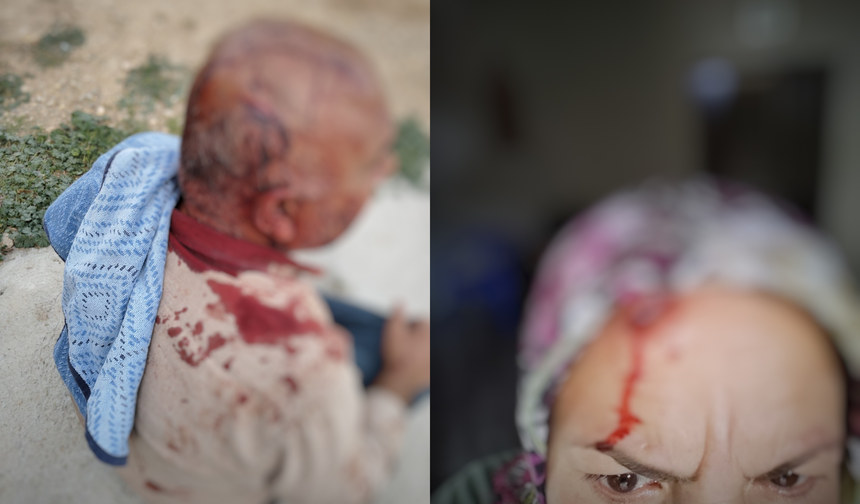Urfa'da hazine arazisi gerilimi! İki kişi darp edildi